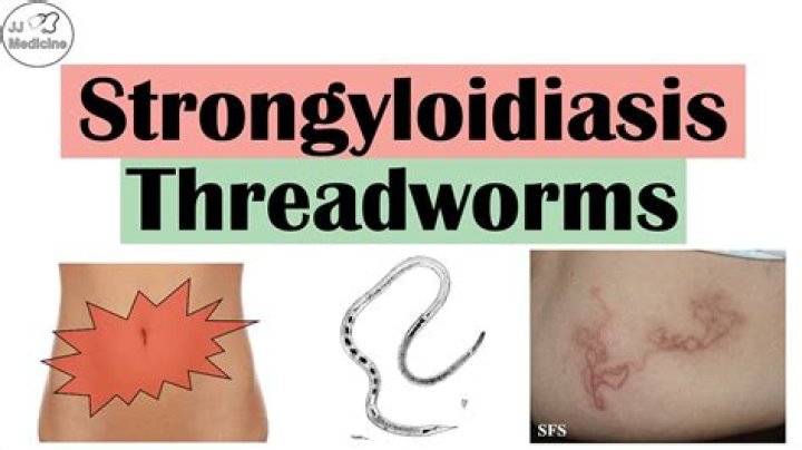 What are the symptoms of threadworms in adults?
