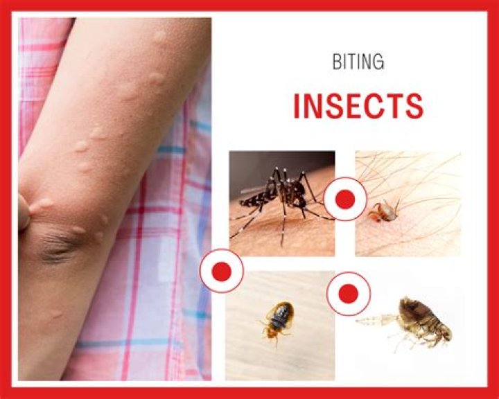 What can I take to keep bugs from biting me?