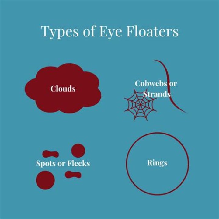 What colors are floaters?