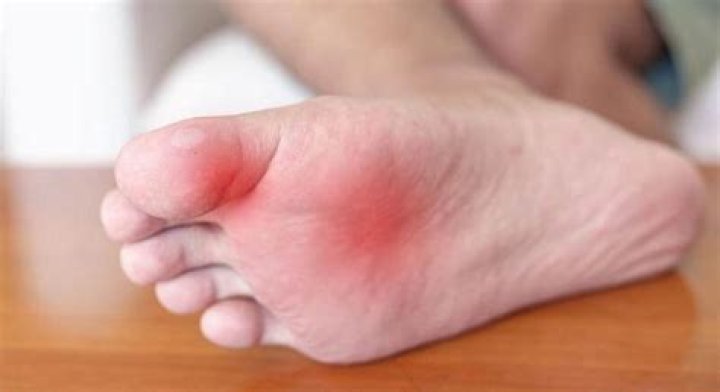 What does a sprained toe feel like?
