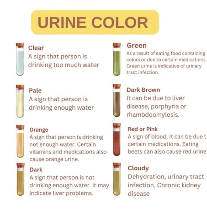 What does dark yellow urine mean?