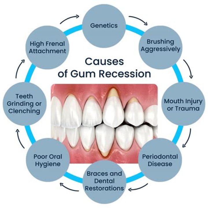 What foods are good for receding gums?