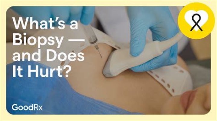 What happens after a lung biopsy?
