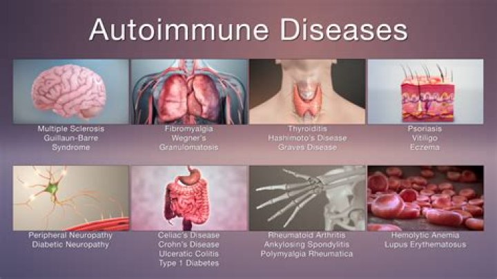 What is a secondary autoimmune disease?