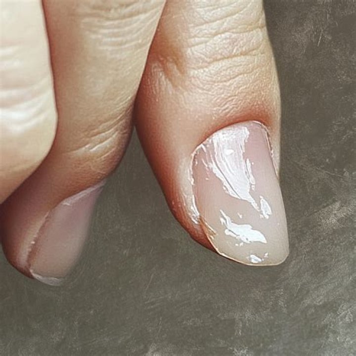 What is a spoon shaped nail?