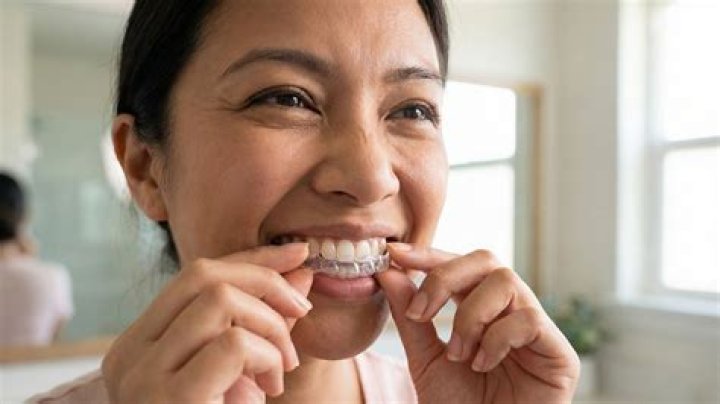 What is the cheapest price for Invisalign?