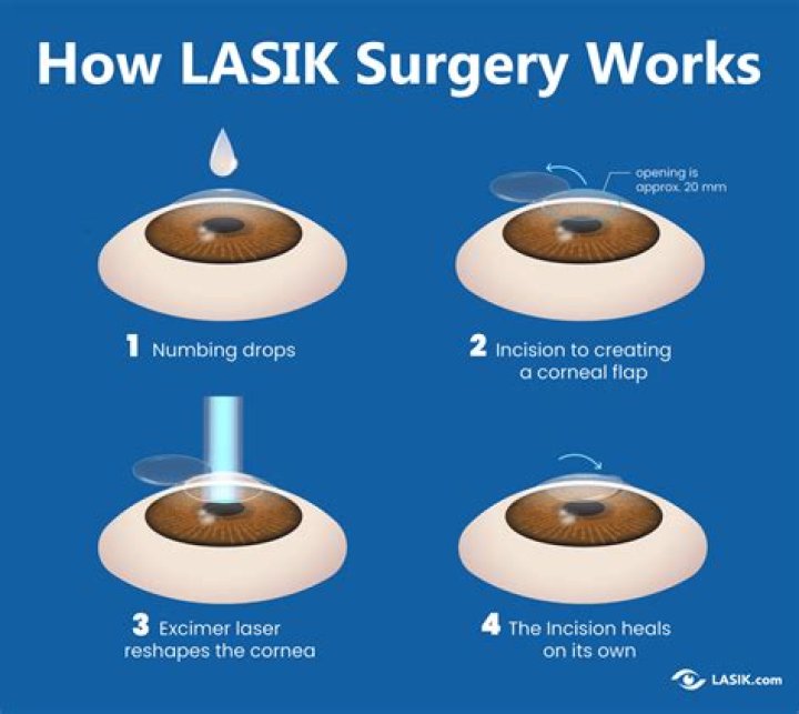 What is the downside of LASIK?
