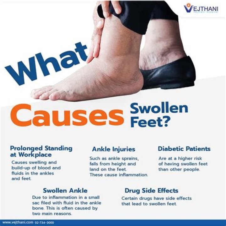 What medications can cause swollen ankles?