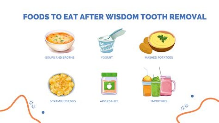 What to do after you get a fish?