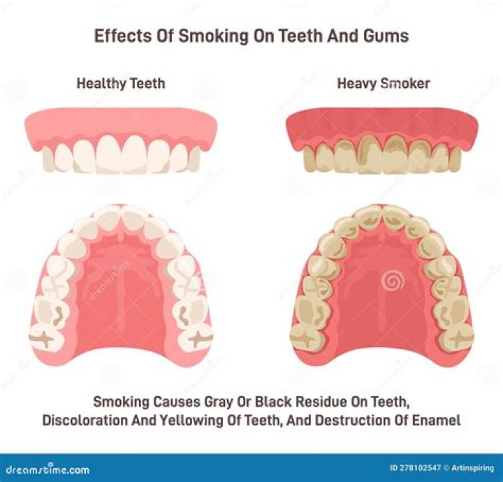 What toothpaste should smokers use?