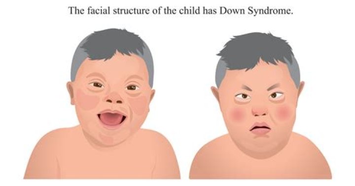 When do babies with Down syndrome start to smile?