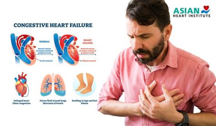 Where is the pain with congestive heart failure?