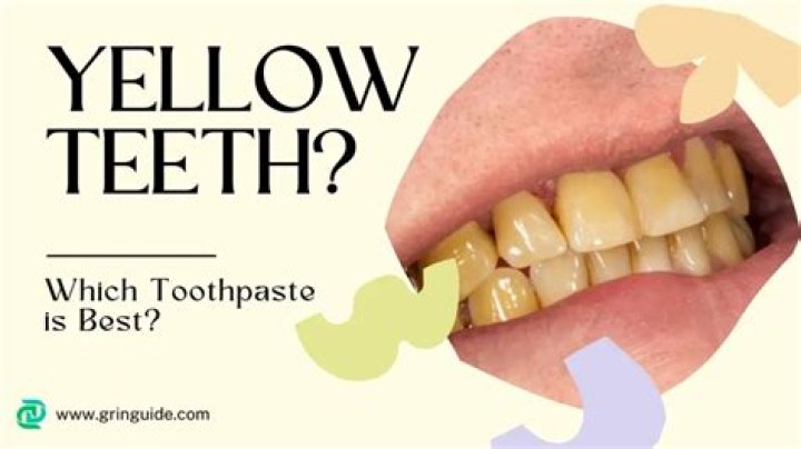 Which toothpaste is best for yellow teeth?