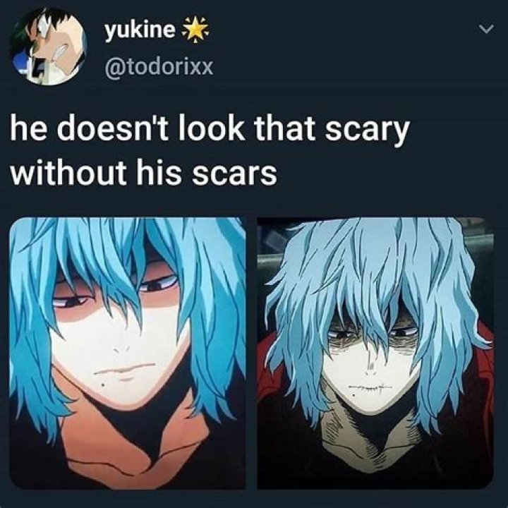 Why did Shigaraki's hair turn blue?
