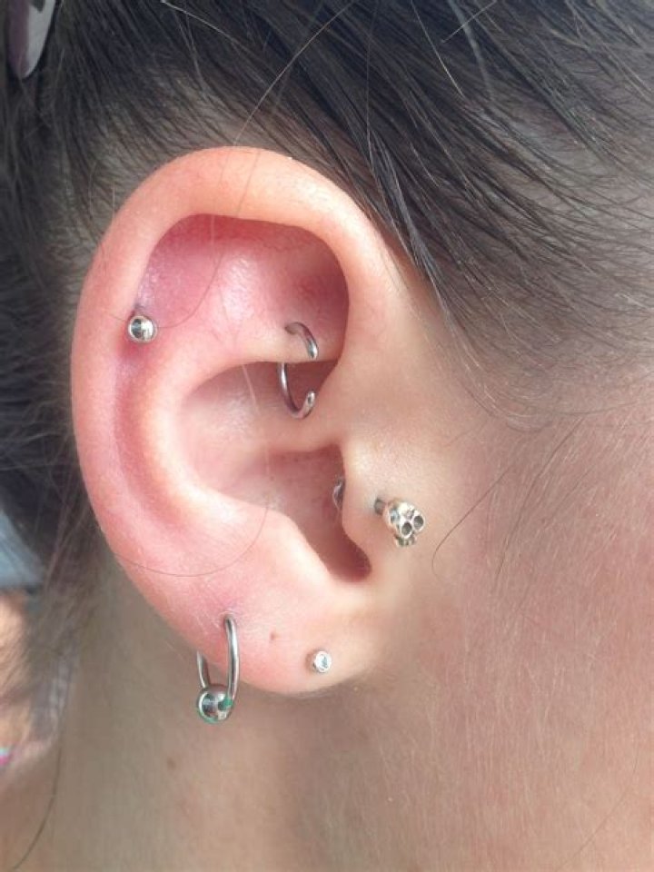 Why do I have a bubble on my piercing?