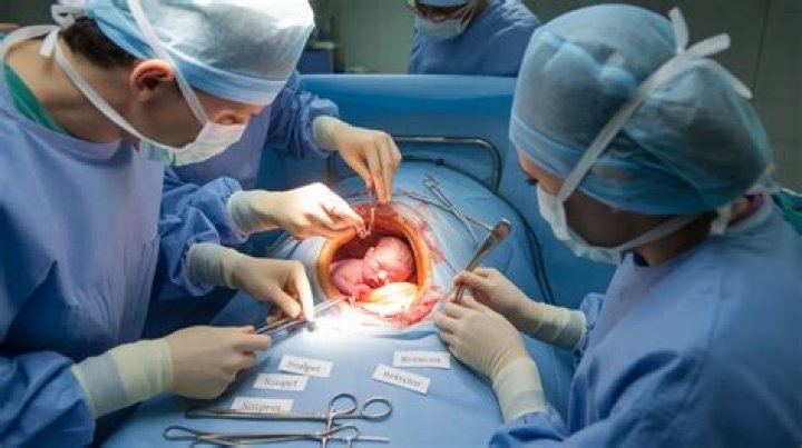 Why do they push on stomach after C-section?