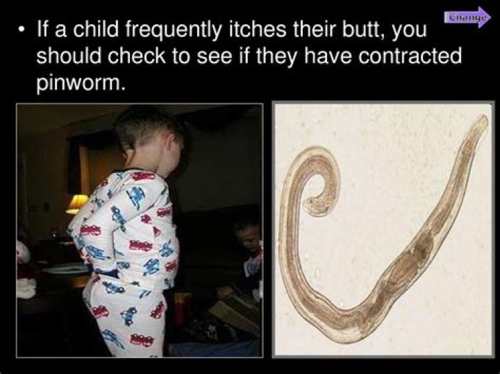 Why does my child keep getting pinworms?