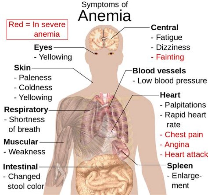 Why does someone get anemia?