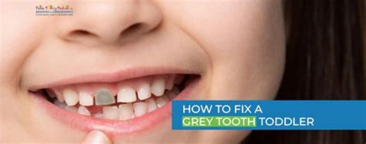 Why is my toddlers tooth gray?