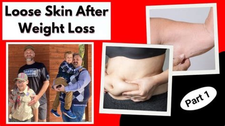 Will losing 2 pounds a week cause loose skin?