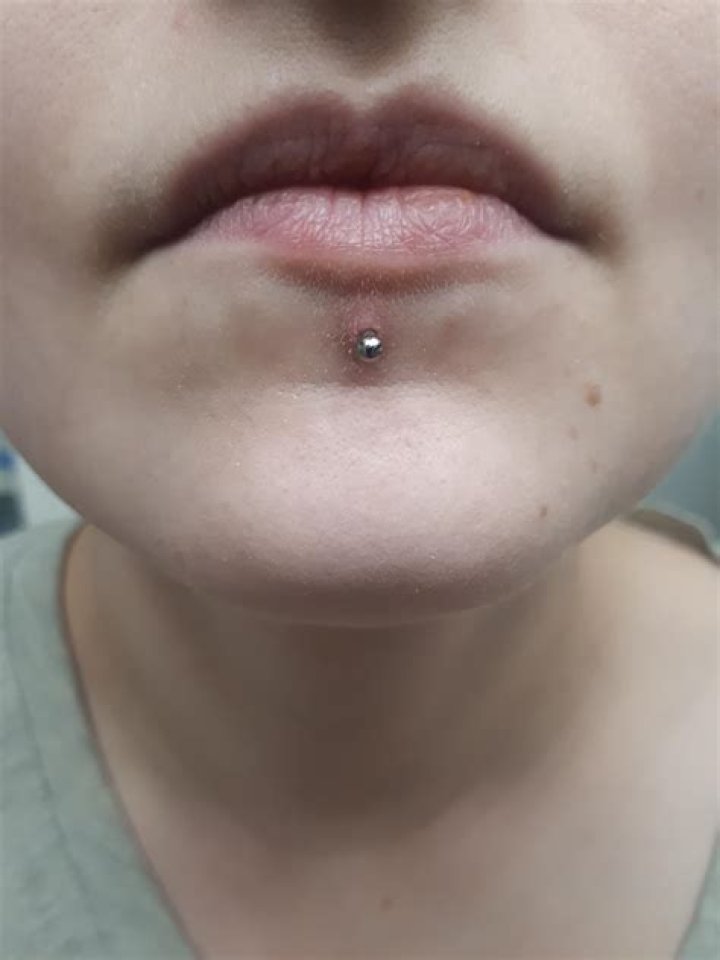 Will my tongue piercing close after 3 years?