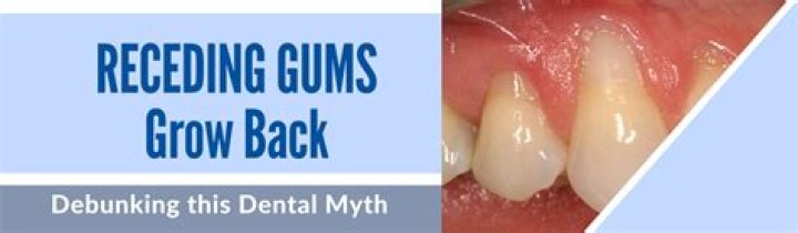Will receding gums grow back?