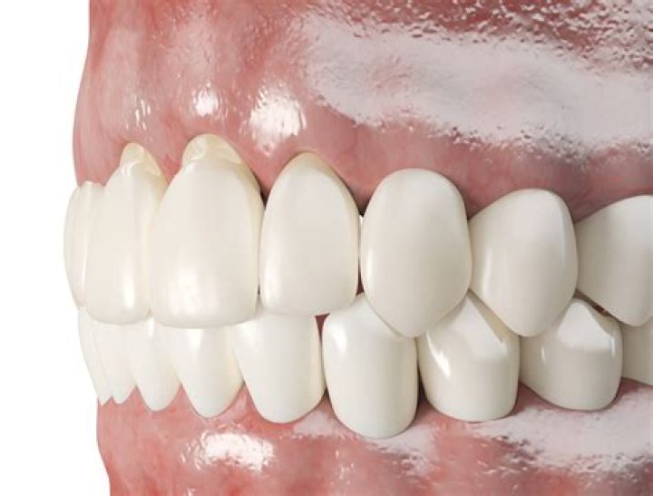 Will receding gums repair themselves?